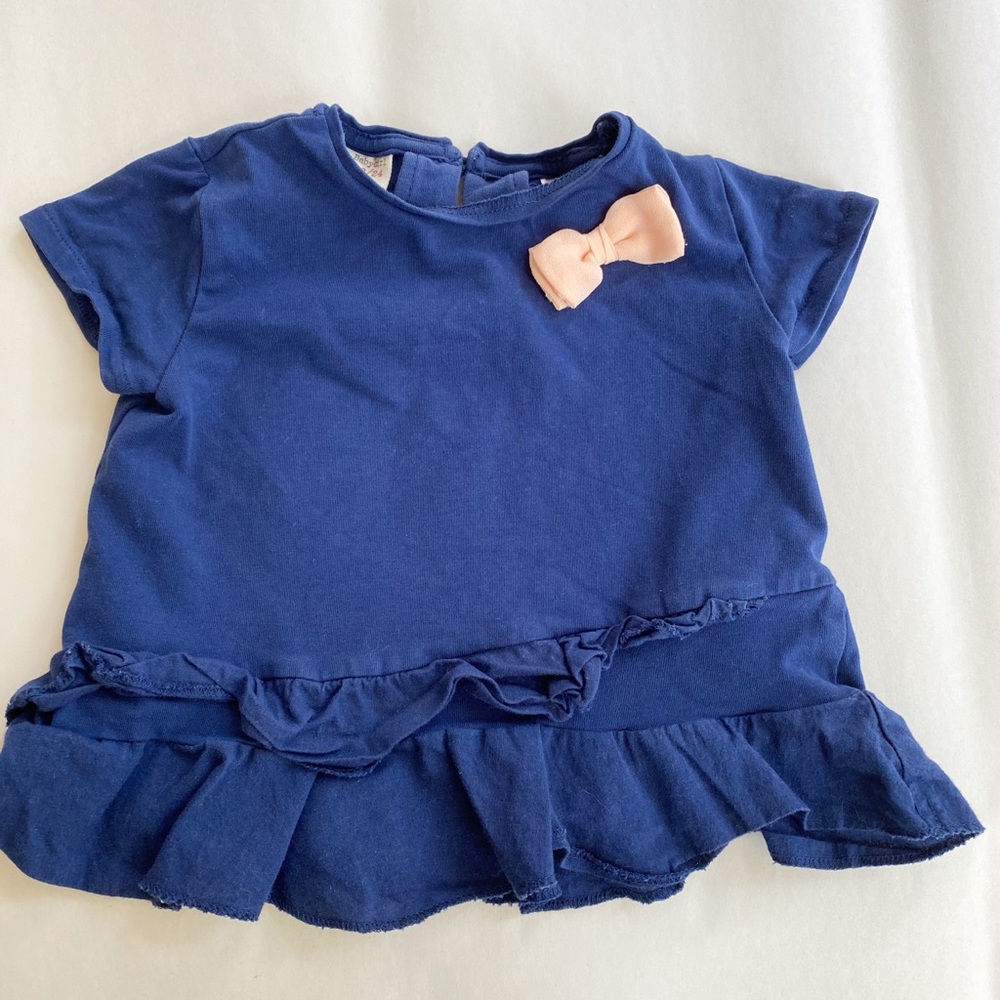 Zara top